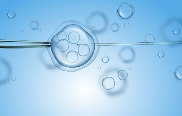 IVF